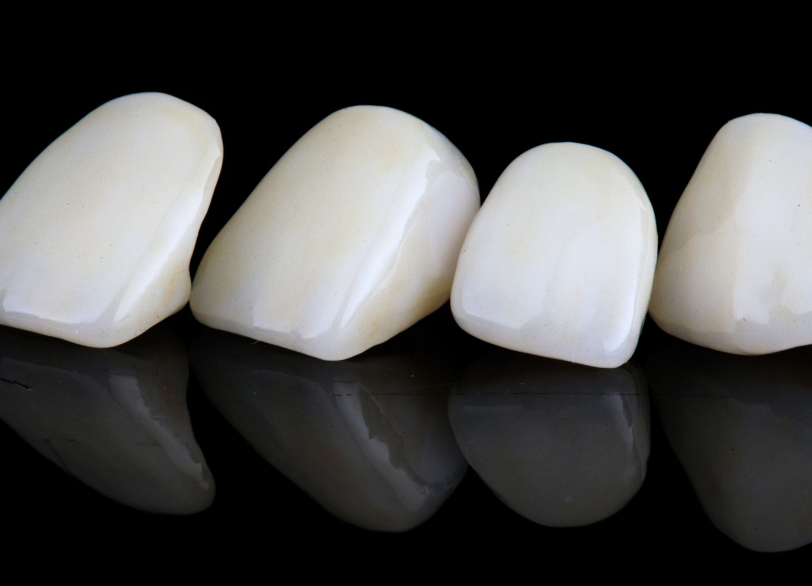 オールセラミック｜古屋歯科