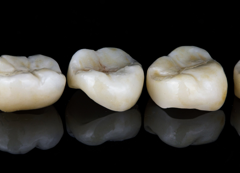 ハイブリッドセラミック｜古屋歯科