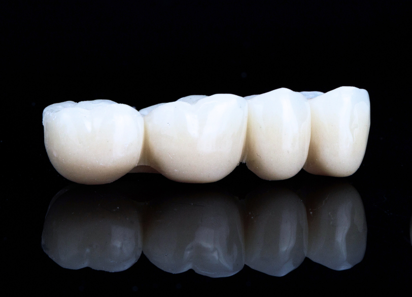 ジルコニアセラミック｜古屋歯科