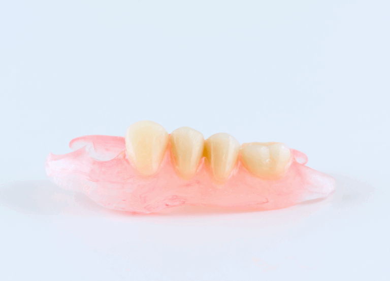 ノンクラスプデンチャー｜古屋歯科