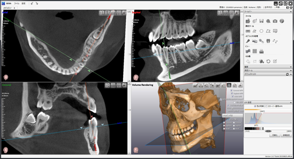 精密な診断｜古屋歯科
