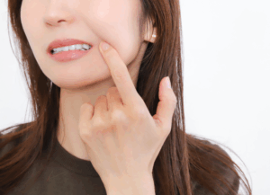 お口の中に現れる問題｜古屋歯科