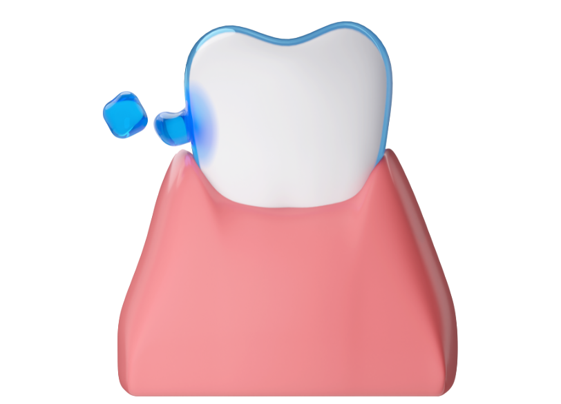 フッ素塗布｜古屋歯科