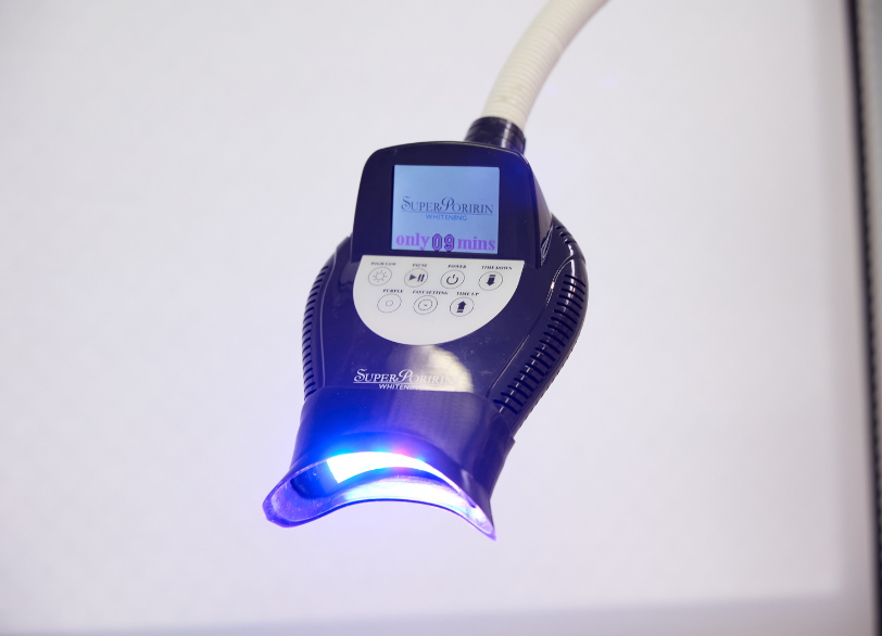 オフィスホワイトニング｜古屋歯科