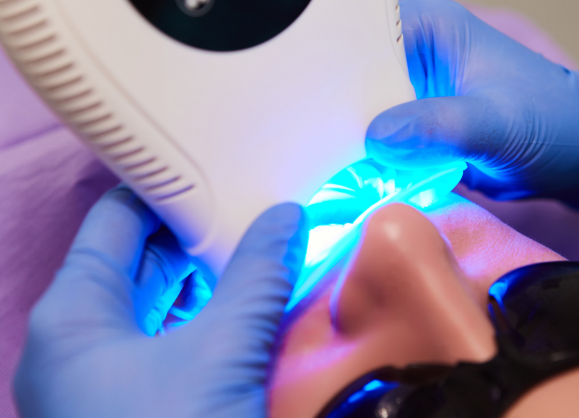 歯科医院のホワイトニング｜古屋歯科