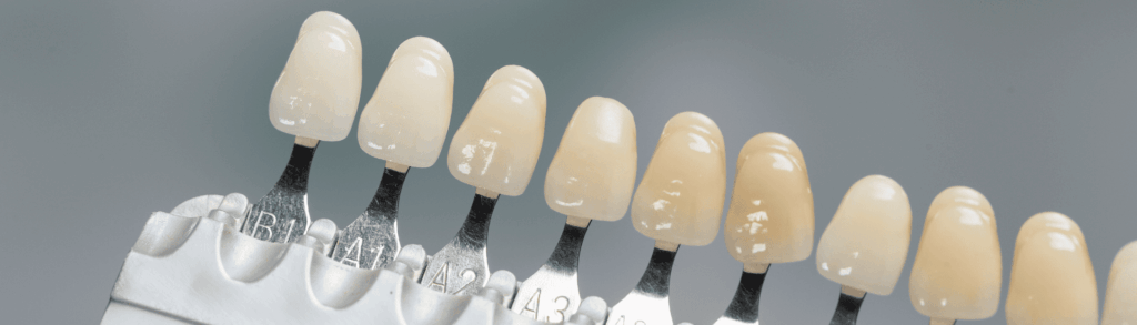 オフィスホワイトニングの施術の流れ｜古屋歯科