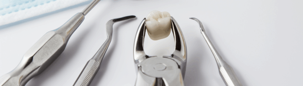 口腔外科が扱う主なお口のトラブル｜古屋歯科