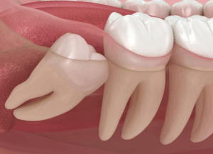 歯並びへの悪影響｜古屋歯科